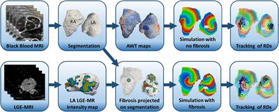 Image-Based Computational Evaluation of the Effects of Atrial Wall Thickness and Fibrosis on Re-entrant Drivers for Atrial Fibrillation